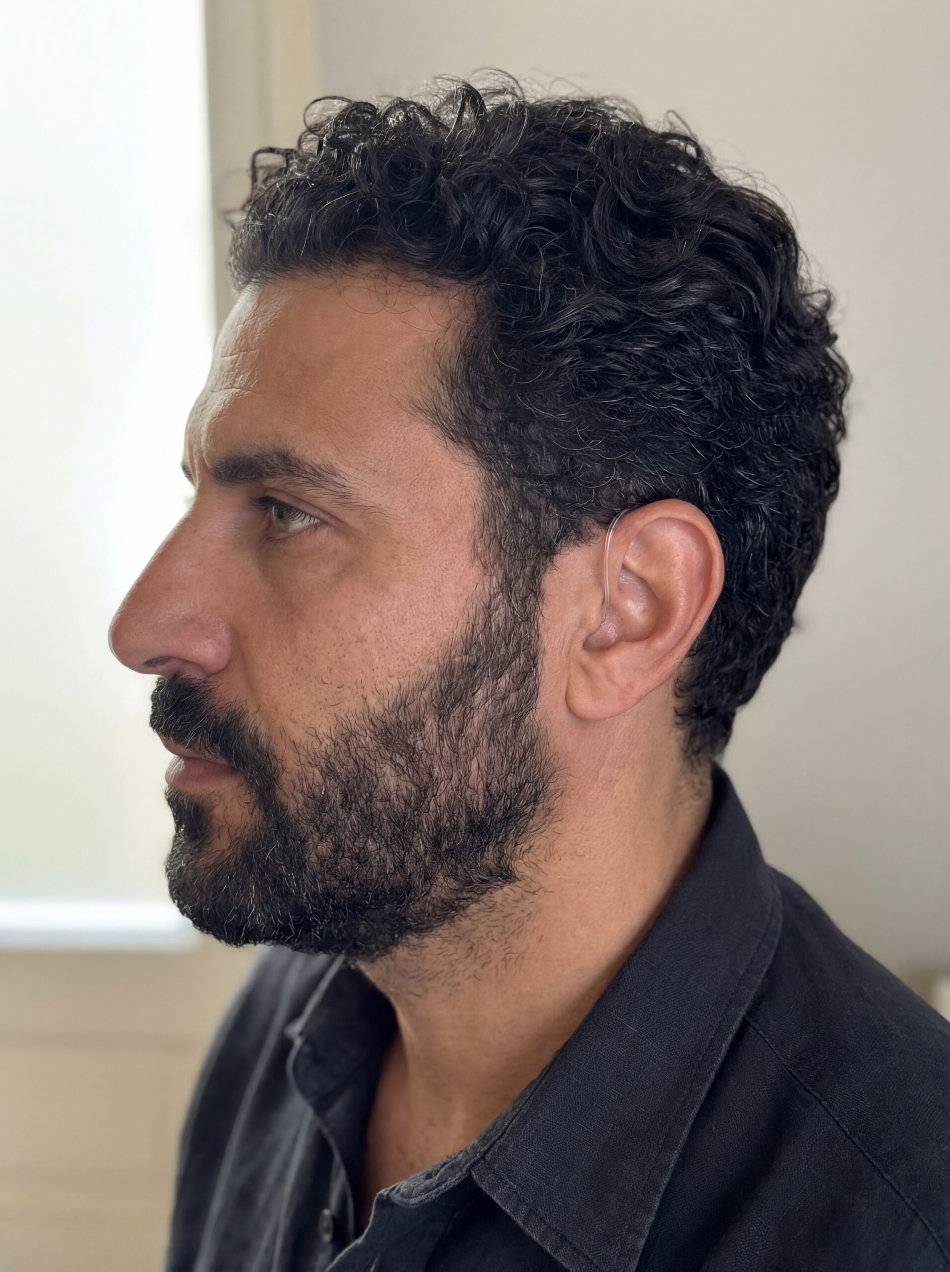 Perte auditive : sympt&ocirc;mes, causes et solutions